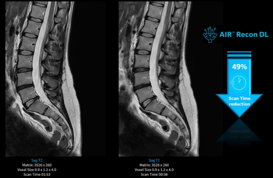 Jornada de IA y ecosistema digital en radiología: cómo ofrecer alta productividad con calidad de manera sostenible mejorando la experiencia del paciente en un servicio de radiología.