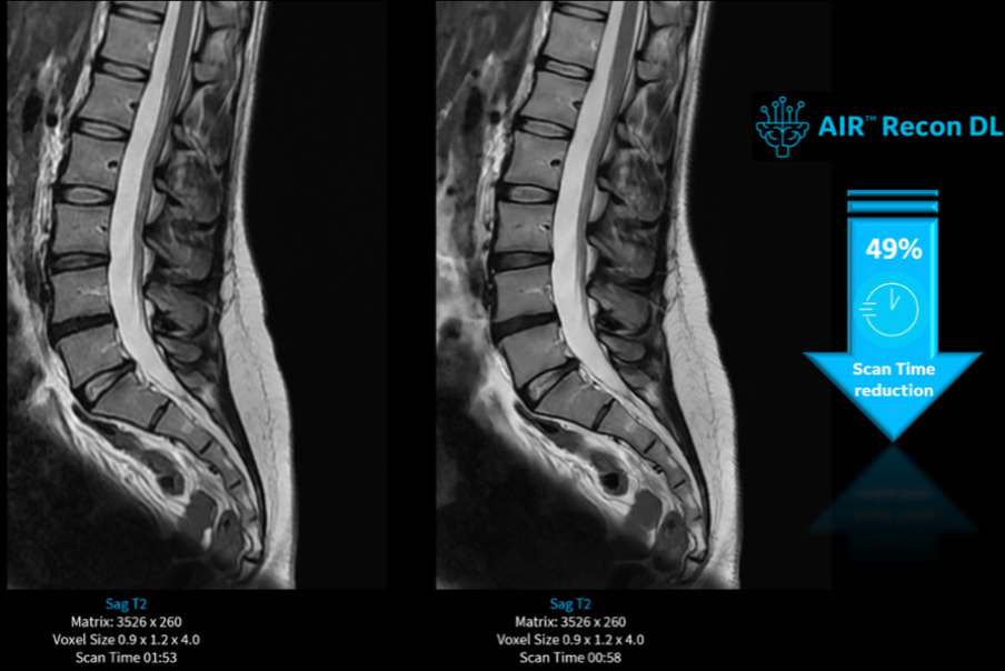 Mejorando la experiencia del paciente en un servicio de radiología